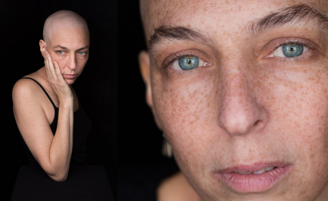  Facing Chemo, a photographic project gallery